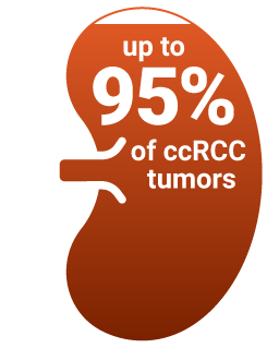 A kidney that is almost fully shaded in and says "up to 95% of ccRCC tumors"
